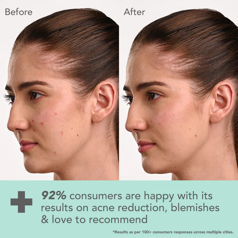 Lotus Herbals - Dermabotanics Kojic Acid + Multi Berry Blemish Free Facewash