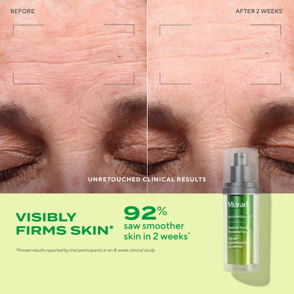Murad Retinol Youth Renewal Serum (30ml)