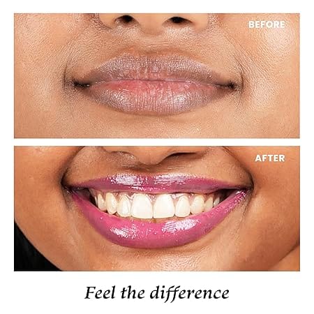 Foxtale - Glazed Lips Brightening Lip Balm Spf 30 (12g)
