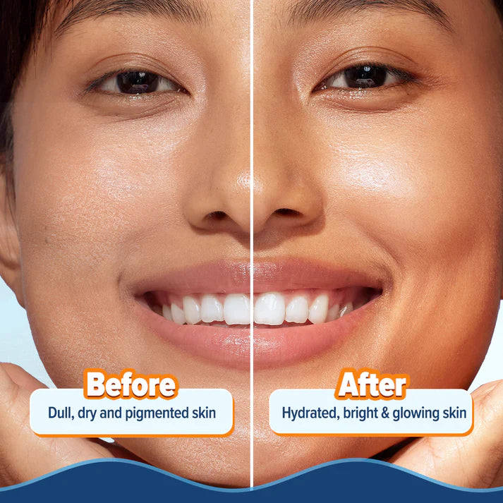 Aqualogica – Glow+ Hydra Gel Moisturizer with Vitamin C & Papaya - (200 g)