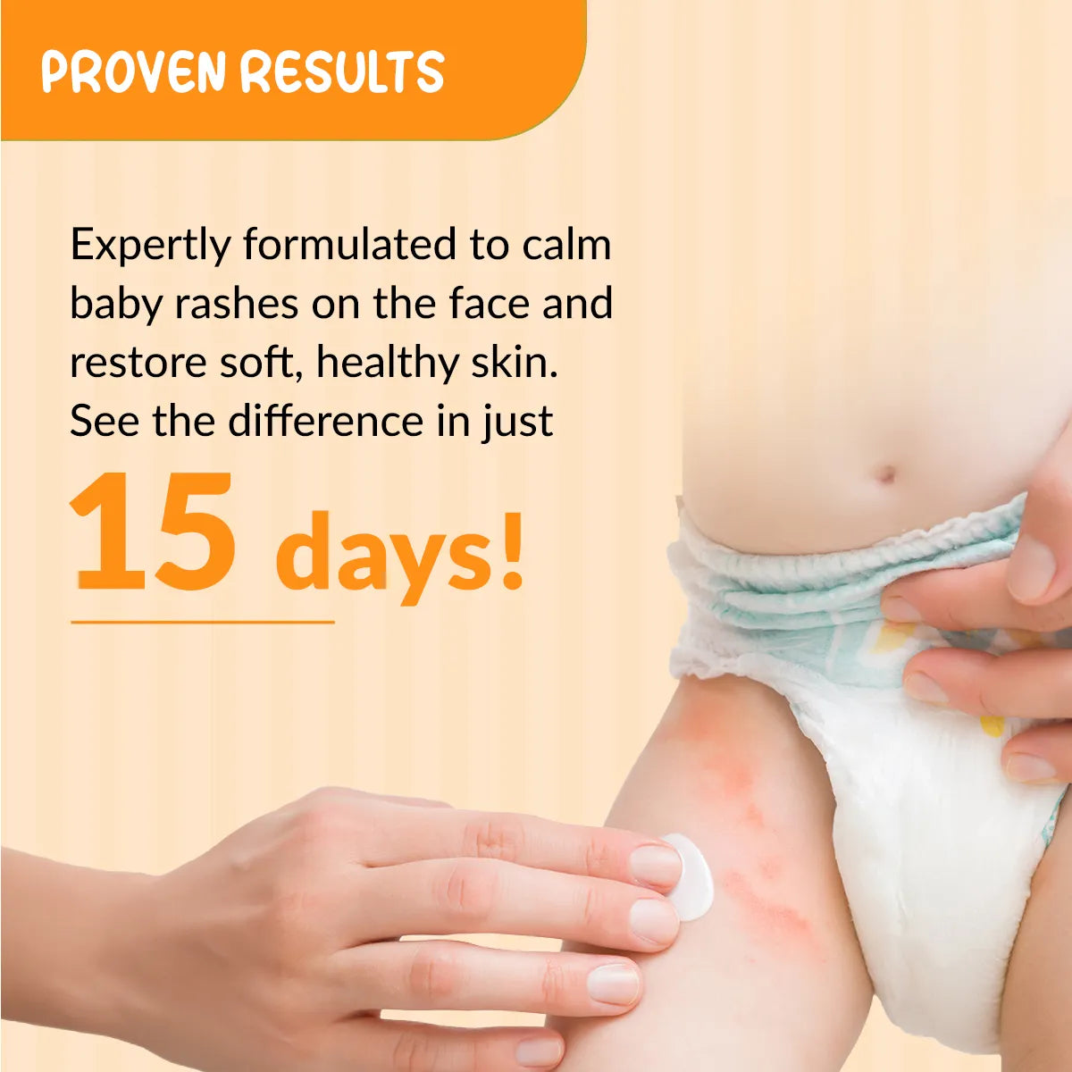 Fixderma – Hoopoe Diaper Rash Cream (50G)