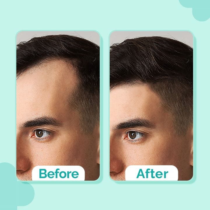 The Derma - Peptide - Stem Cell Hair Growth Serum Boosts Hair Growth (30ML)