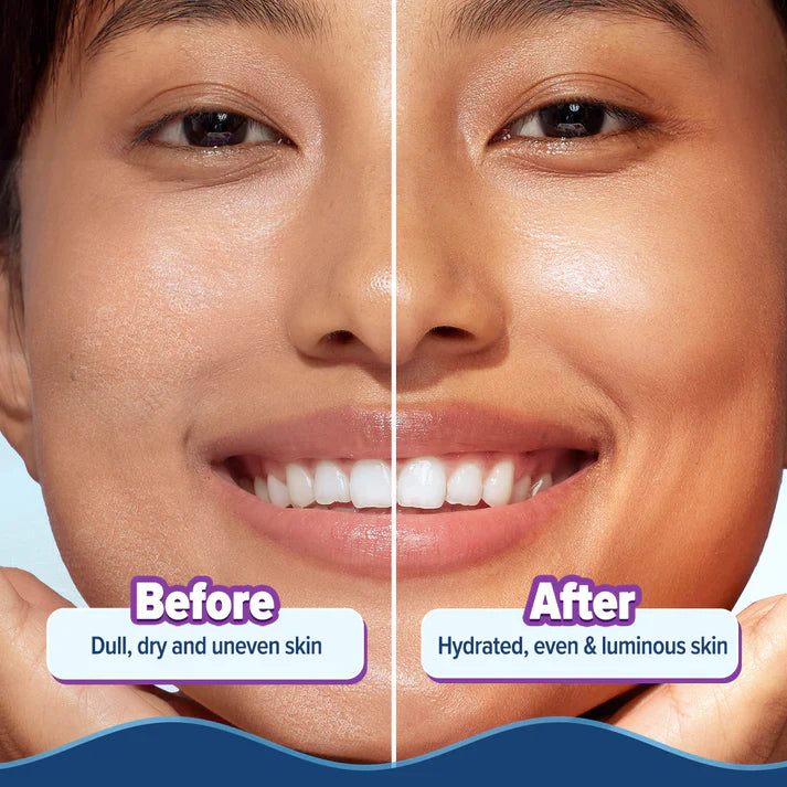 Aqualogica – Illuminate + Hydra Gel Moisturizer with Wild Berries & Alpha Arbutin - (200g)