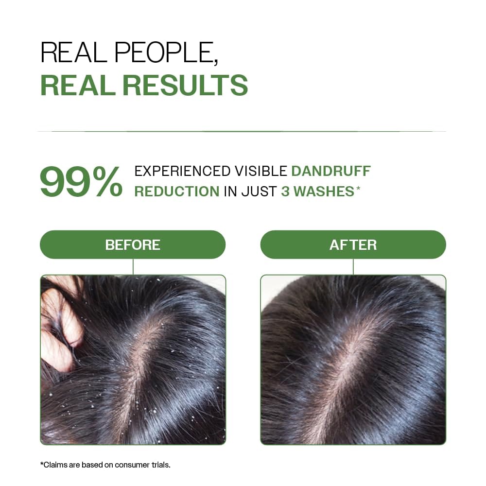 Bare Anatomy - Anti - Dandruff Shampoo (250ML)