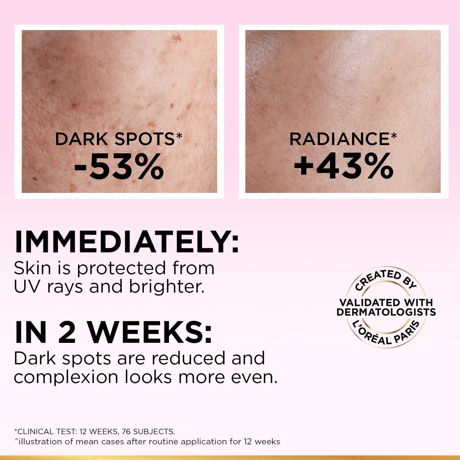 Loreal Paris - Glycolic Bright Anti Dark Spot Daily UV Fluid Spf 50+ (50ML)