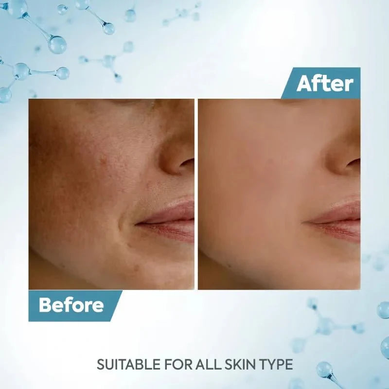 Raaga Professional De-Tan Tan Removal Cream single use