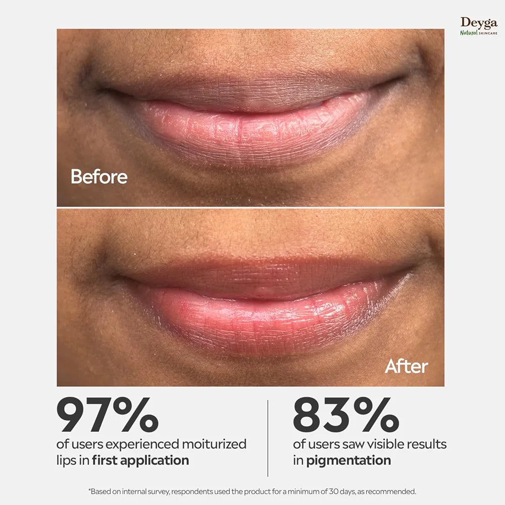 Deyga Beetroot Lip Balm | Tinted Lip Care | For Dry & Chapped Lips | For Pigmented Lips | For Women & Men (Pack of 1, Stick Lip Balm), Red