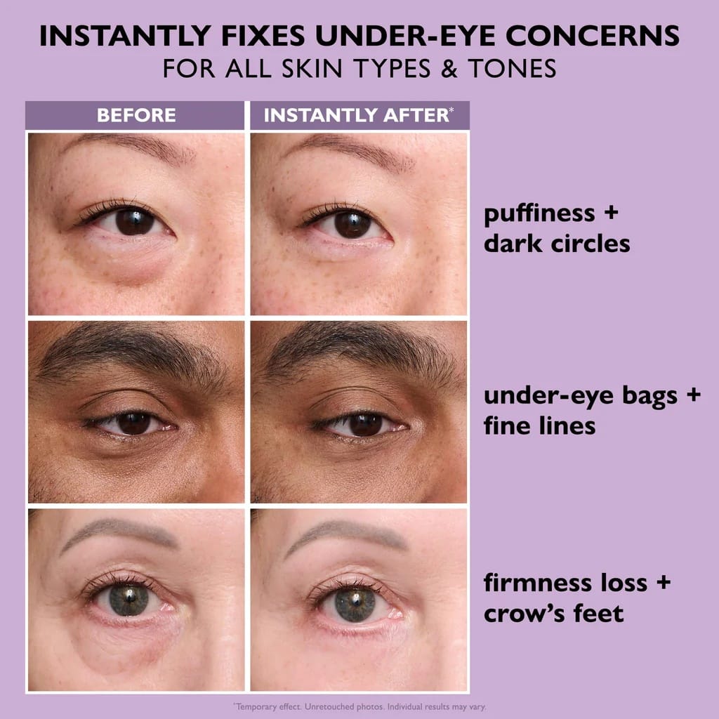 Peter Thomas Roth - Instant FIRMx Eye Temporary Eye Tightener (20ML)