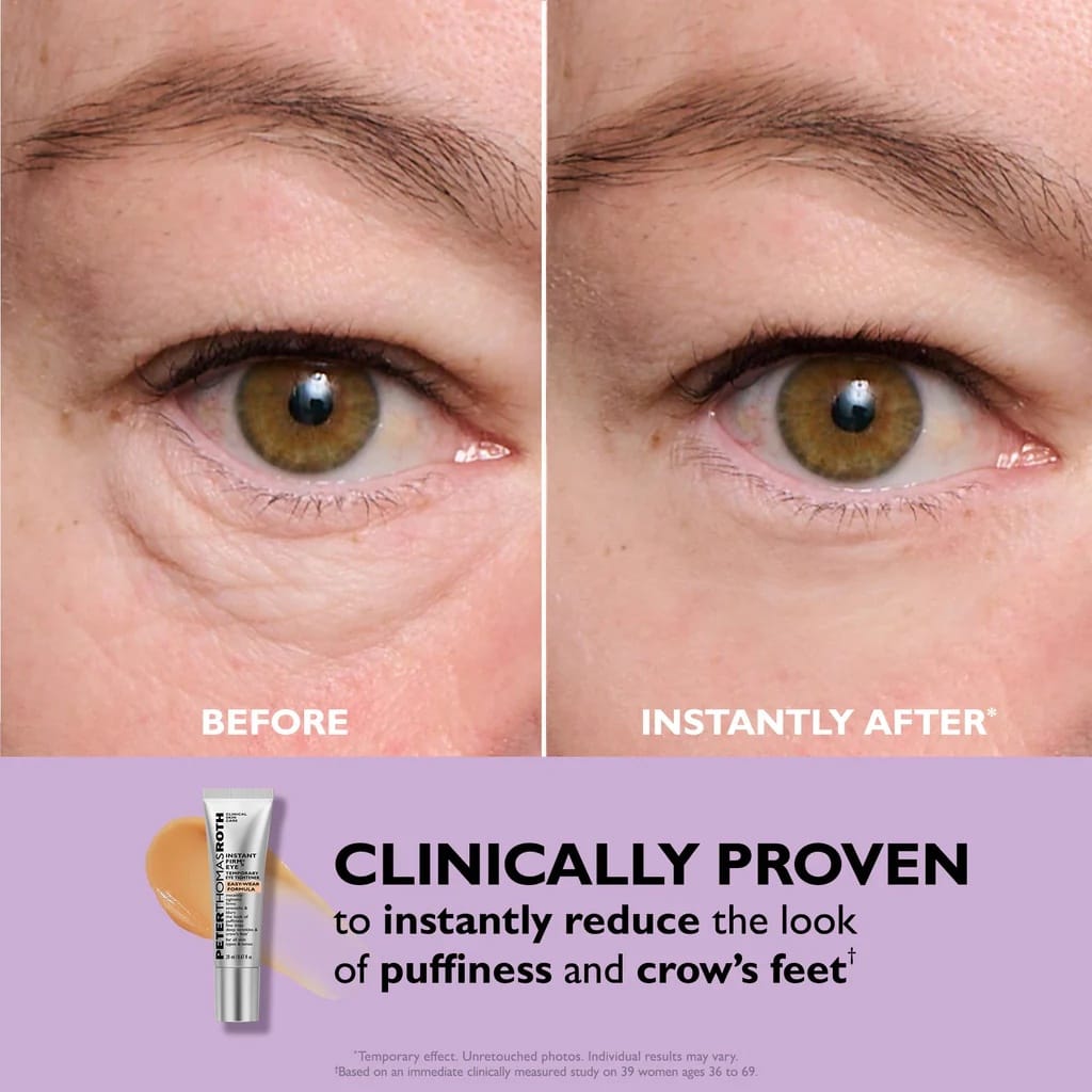 Peter Thomas Roth - Instant FIRMx Eye Temporary Eye Tightener (20ML)